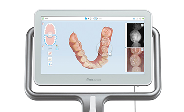 スキャナーの写真