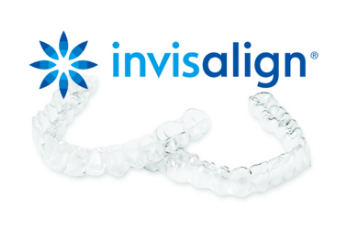 インビザライン矯正