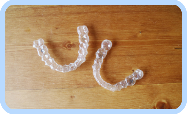 マウスピースの写真