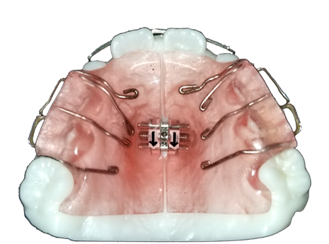 マイオスマイル